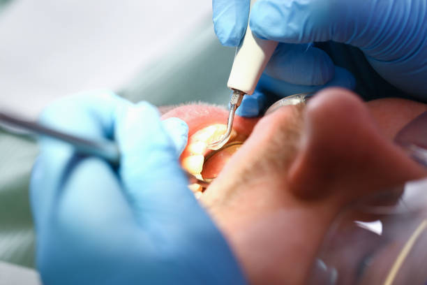 Best After-Hours Emergency Dentist in Anna, TX