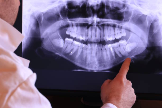 Best Emergency Dental Surgery in Anna, TX