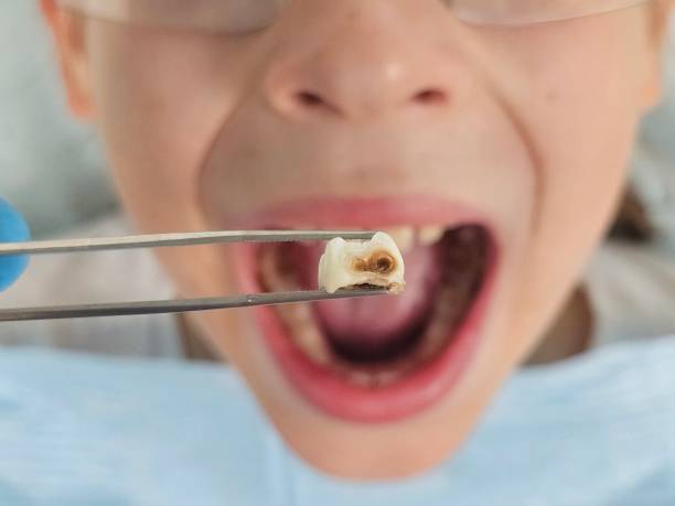 Best Urgent Dental Care in Anna, TX