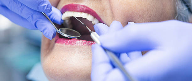 Best Emergency Wisdom Teeth Removal in Anna, TX